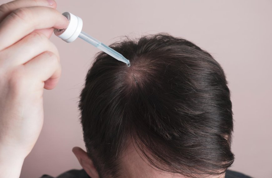 Top Hair Growth Products Every Man Should Know About